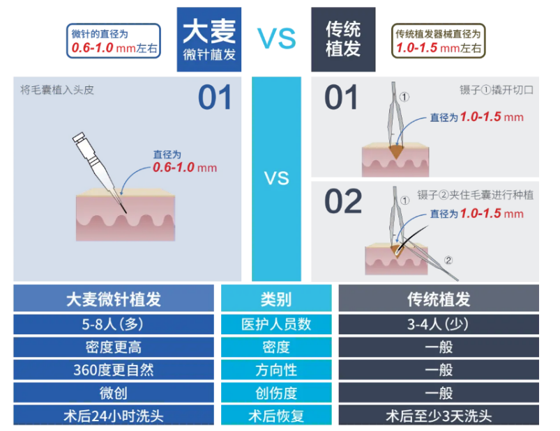 植发群体越来越年轻化  大麦不剃发微针植发脱颖而出